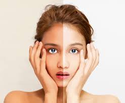 Beyond Whitening: ວິທີການວິທະຍາສາດຂອງ Synlotic Biotech ເພື່ອຜິວທີ່ສົດໃສ, ລຽບນຽນ